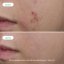 Sérum pro aknózní pleť - NOVEXPERT Trio‑Zinc Serum