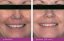 Zesvětlující čisticí pěna - ELURE Advanced Facial Wash 100 ml