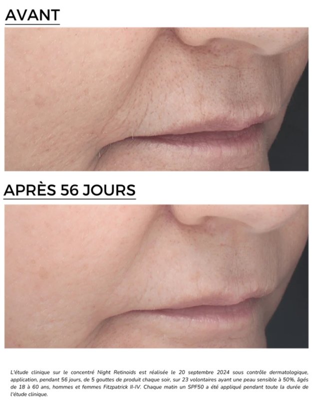 Omlazující noční sérum - DERMEDEN Retinal Retinoids 30 ml
