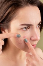 Gel na problematickou pleť s akné - BIRETIX Tri-Active Gel 50 ml