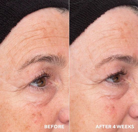 Exfoliace a zesvětlení pleti - HYDROPEPTIDE Liquid Resurfacing Solution 120 ml