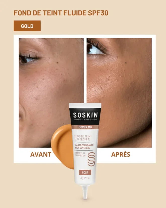 Soskin Fluid Foundation SPF30 - Gold