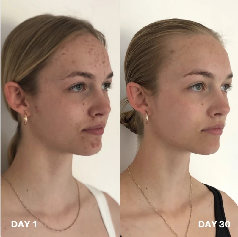 Zklidňující čistící tonikum - CLINISOOTHE Skin Purifier 250 ml