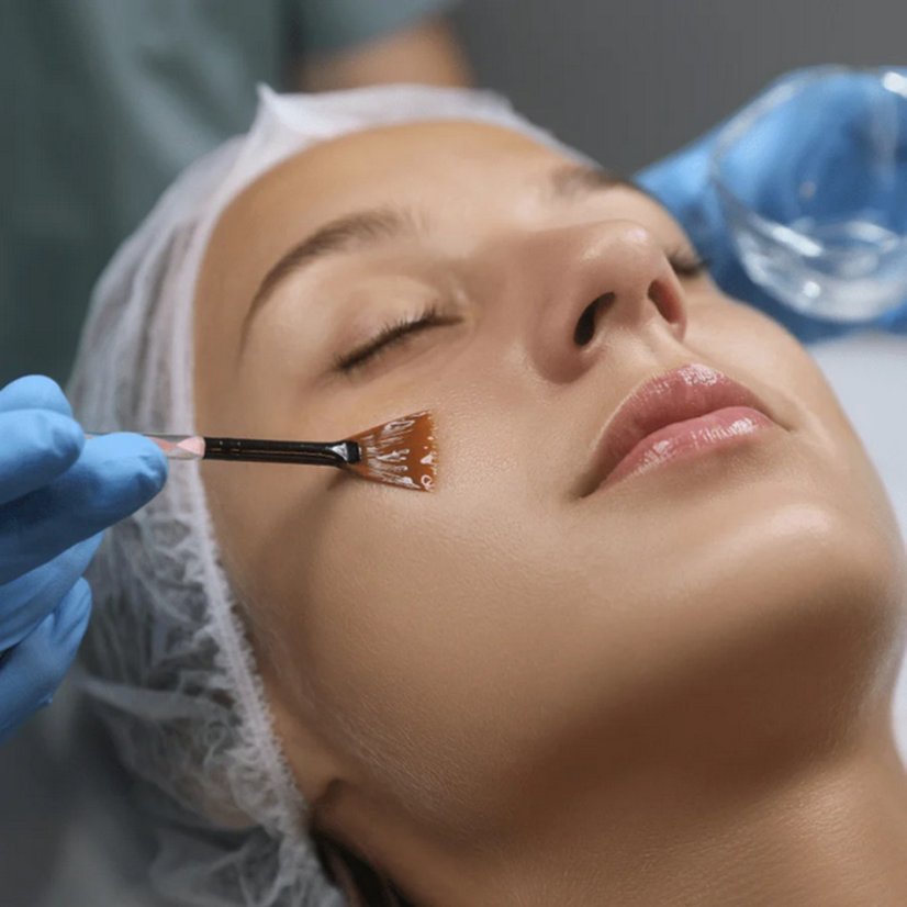 Domácí peeling - DERMEDEN Advanced Peel 2 x 30 ml