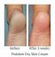 NEOSTRATA Problem Dry Skin Cream - Krém pro extrémně suchou pokožku 100 g