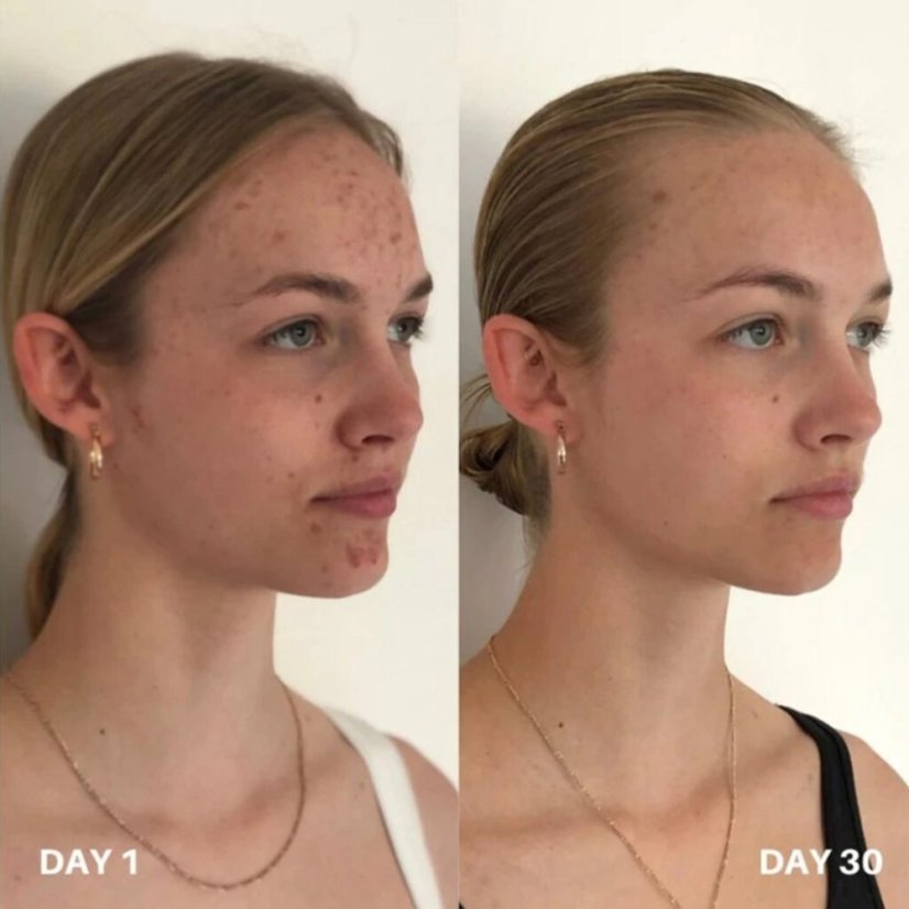 Zklidňující čistící tonikum - CLINISOOTHE Skin Purifier 100 ml