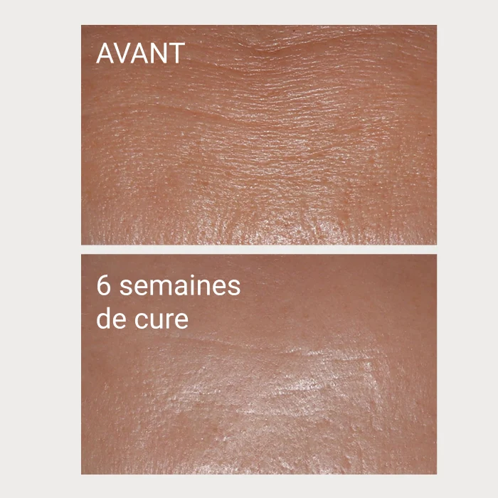 Přírodní doplněk stravy NOVEXPERT Collagen+ (21 sáčků)